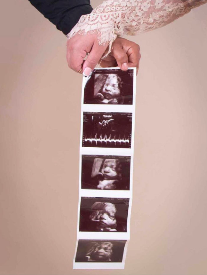 Couple holding a strip of ultrasound photos announcing their pregnancy, maternity photoshoot